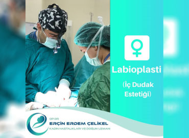 Labioplasti(iç dudak estetiği)